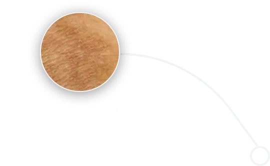 pigmentation